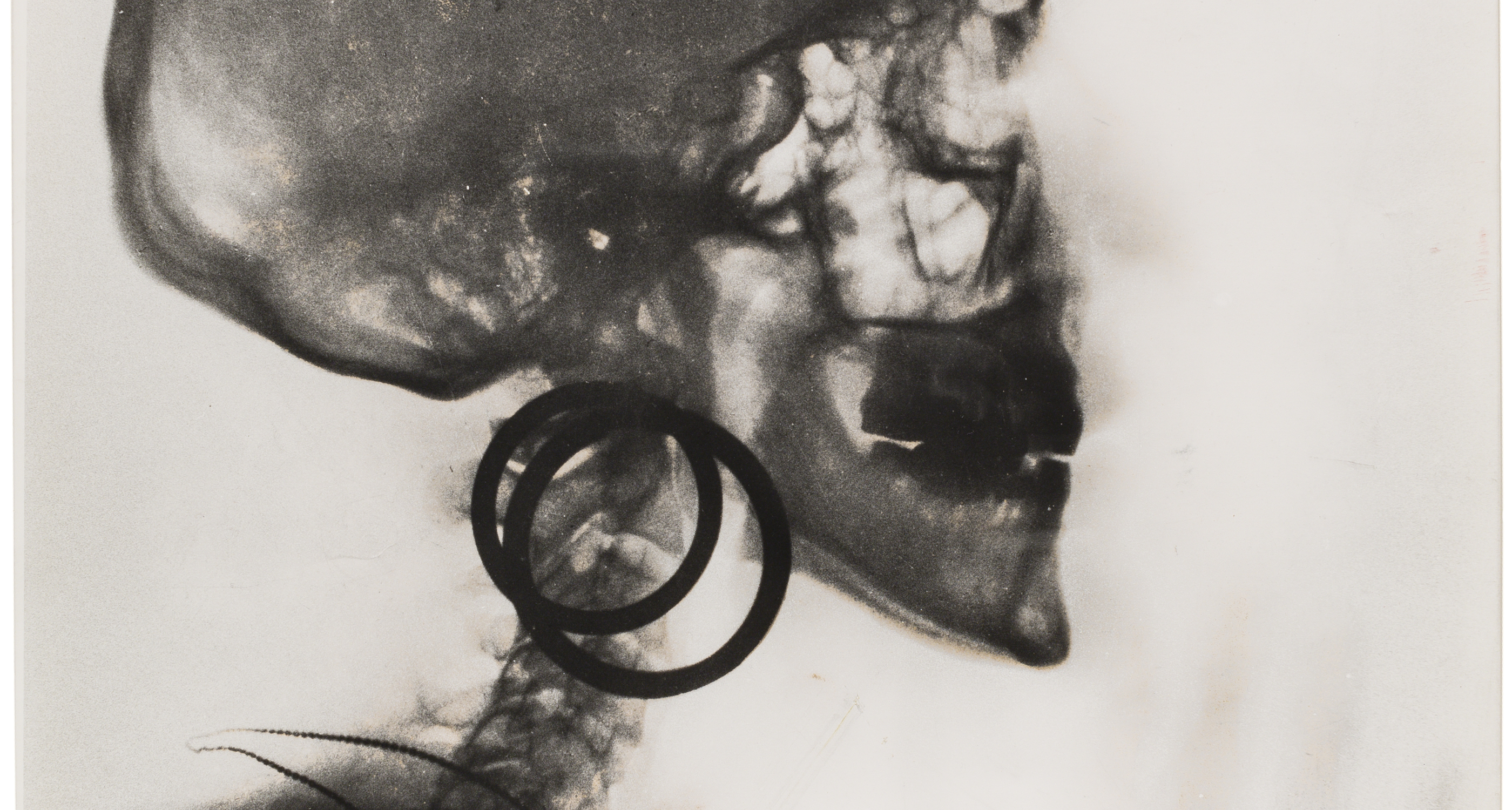 X-Ray of Meret Oppenheim's Skull