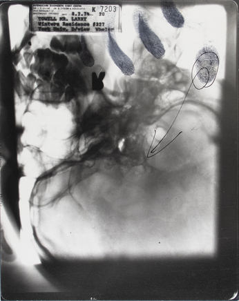 Larry Towell, Untitled [X-ray], 1974