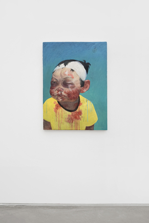 Face And Pore Installation View 14