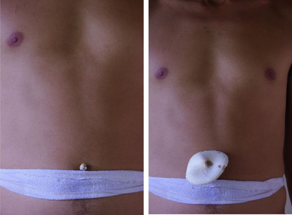 Paulo Nazareth, fungo - liberdade -MG - BRASIL, 2010