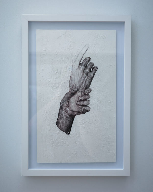 Armando Franco, Amputacion, 2022