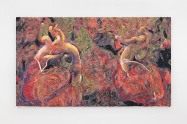 Agnes Questionmark, Double heart MRI, 2025