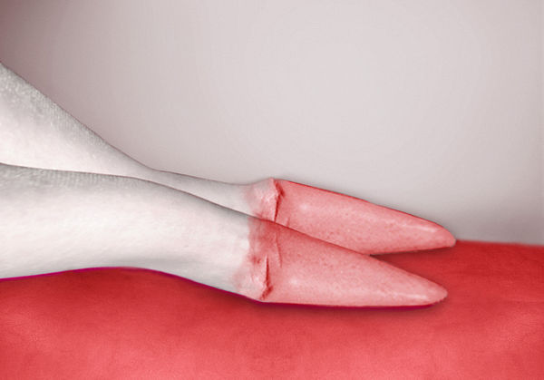 Pat Brassington, Rules of Engagement, 2017