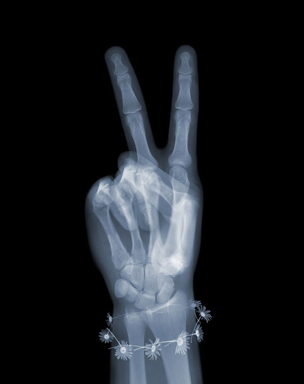 Nick Veasey, Peace with Daisies, 2019