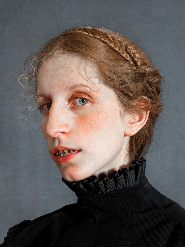 Romina Ressia, Freckles and Brackets