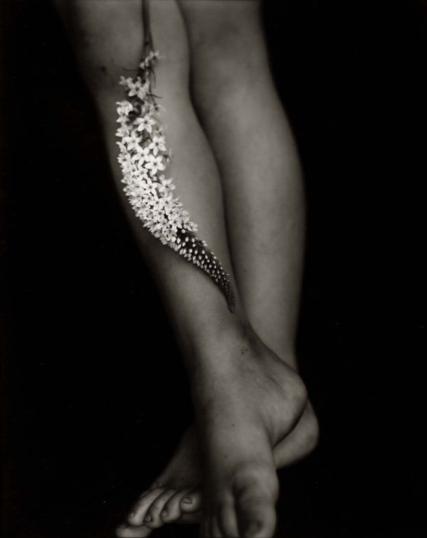 Gooseneck loosestrife on leg, from the Immediate Family series by Sally Mann