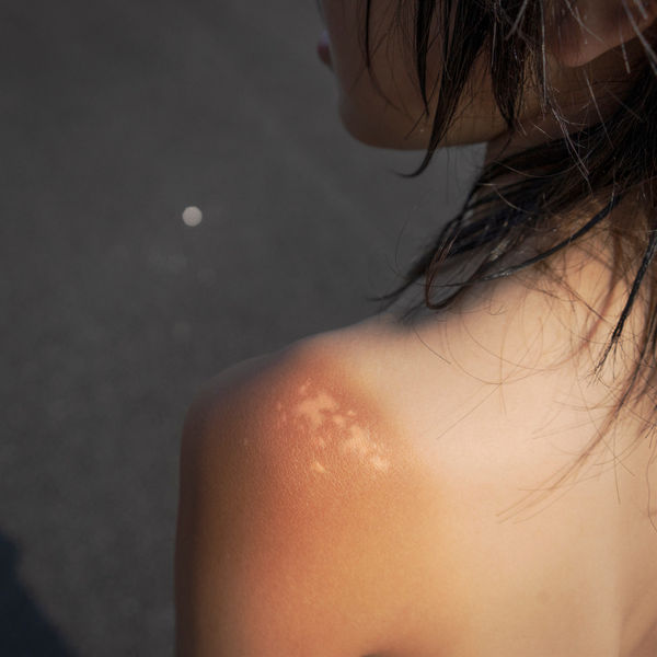 Takako Kido, Sunburn, 2022