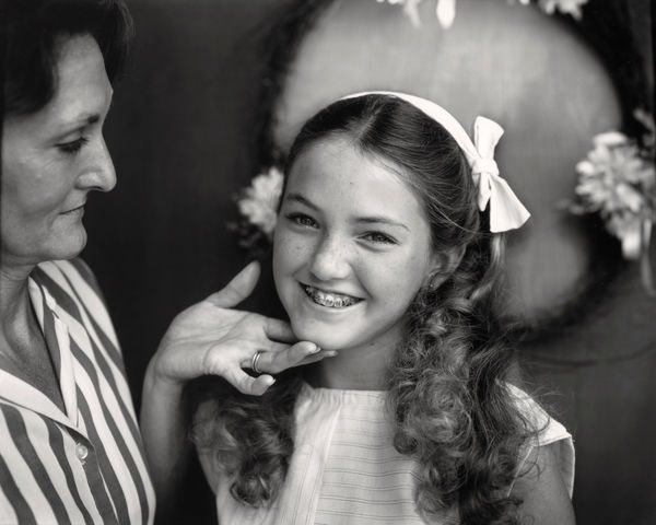 Sally Mann, Little Miss Rockbridge Gets Braces (At Twelve), 1983-1985