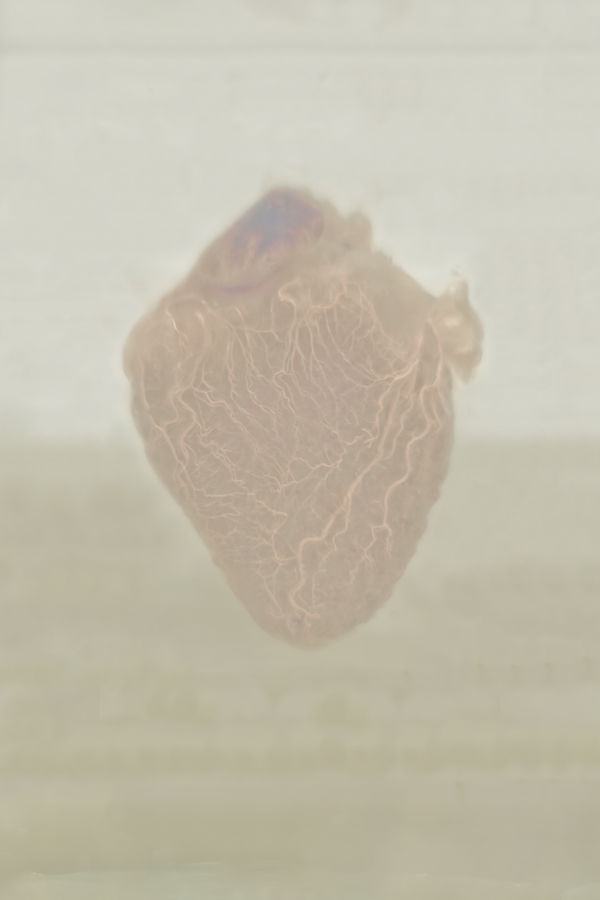 Daniel Malva, Homo sapiens: cor, 2010