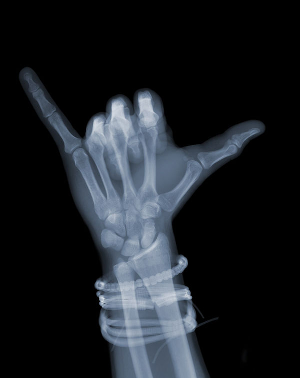 Nick Veasey, Hang Loose with Bands, 2019