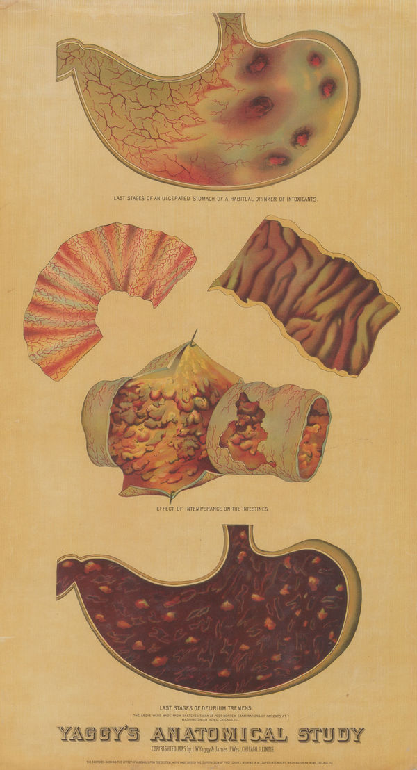 Levi Walter Yaggy, Anatomy - Stomach and Intestines, 1886