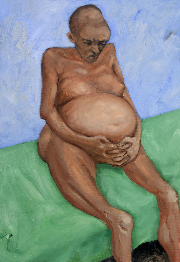 Sudhir Patwardhan Ascites, 2019 Oil on canvas