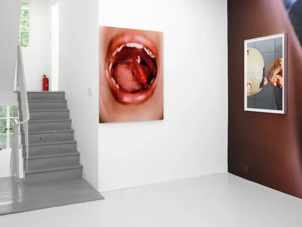 3Abdcf7045B93341602A