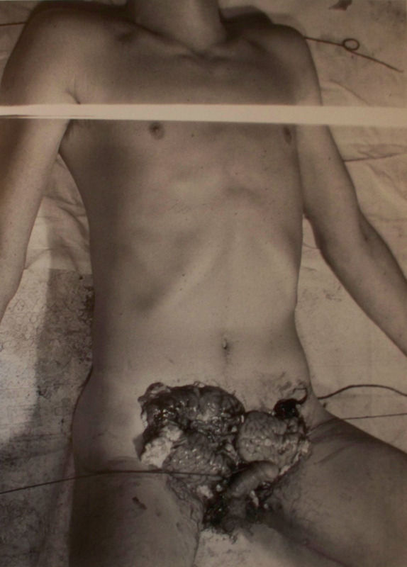 Hermann Nitsch, The Pharmacy, 1965-2011