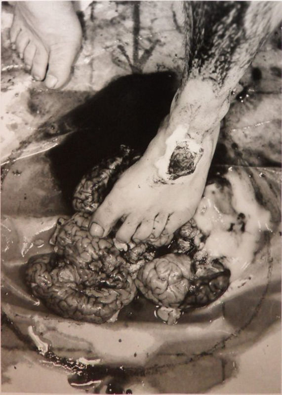 Hermann Nitsch, The Pharmacy, 1965-2011