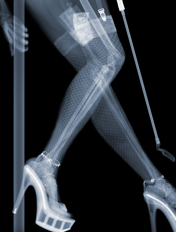 Stripper, 2014 22 x 16 1/2 in., Ed. 25 33 x 25 in., Ed. 9 47 x 35 1/2 in,. Ed. 5