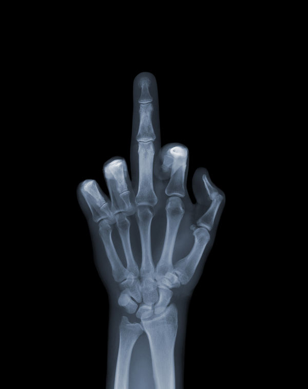 The Finger, 2001 50 x 40 in., Ed. 50