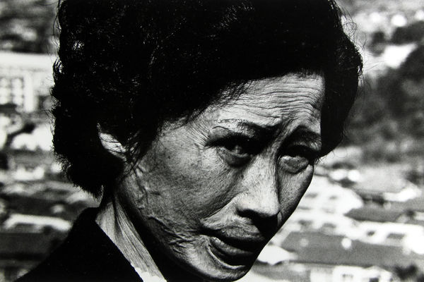 Shōmei Tōmatsu, Kataoka Tsuyo, She was injured 1.4km from the epicentre of the blast, 1961