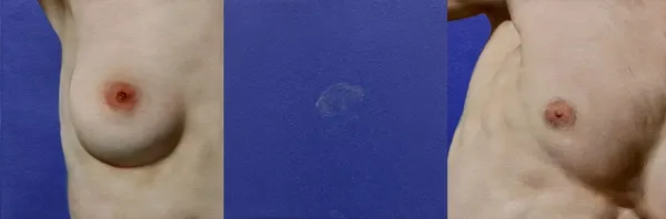 L’ALTRA FIGURA, 2022