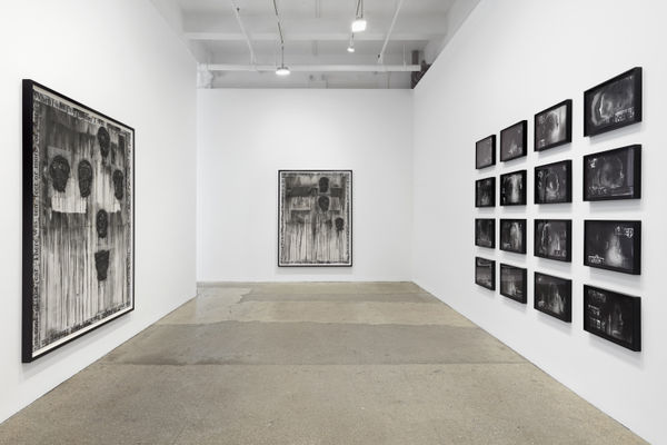 Jp Glny2024 Install 13