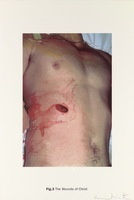 DAMIEN HIRST Fig. 3 Wounds of Christ New Religion - The Wounds of Christ Silkscreen print on Somerset satin 410gsm Edition of 55 Signed and numbered Sheet: 100 x 66.7 cm 2005 Available only as part of the portfolio