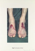 DAMIEN HIRST Fig. 6 The Wounds of Christ New Religion - The Wounds of Christ Silkscreen print on Somerset satin 410gsm Edition of 55 Signed and numbered Sheet: 100 x 66.7 cm 2005 Available only as part of the portfolio