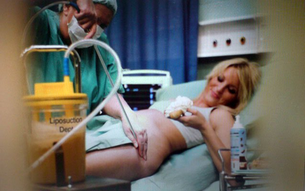 Alison Jackson, Britney has Lipo, 2007