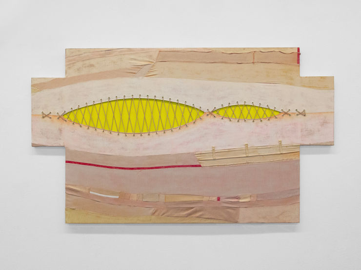 Andrius Alvarez-Backus, They Let Intimacy Fuse Them, 2025