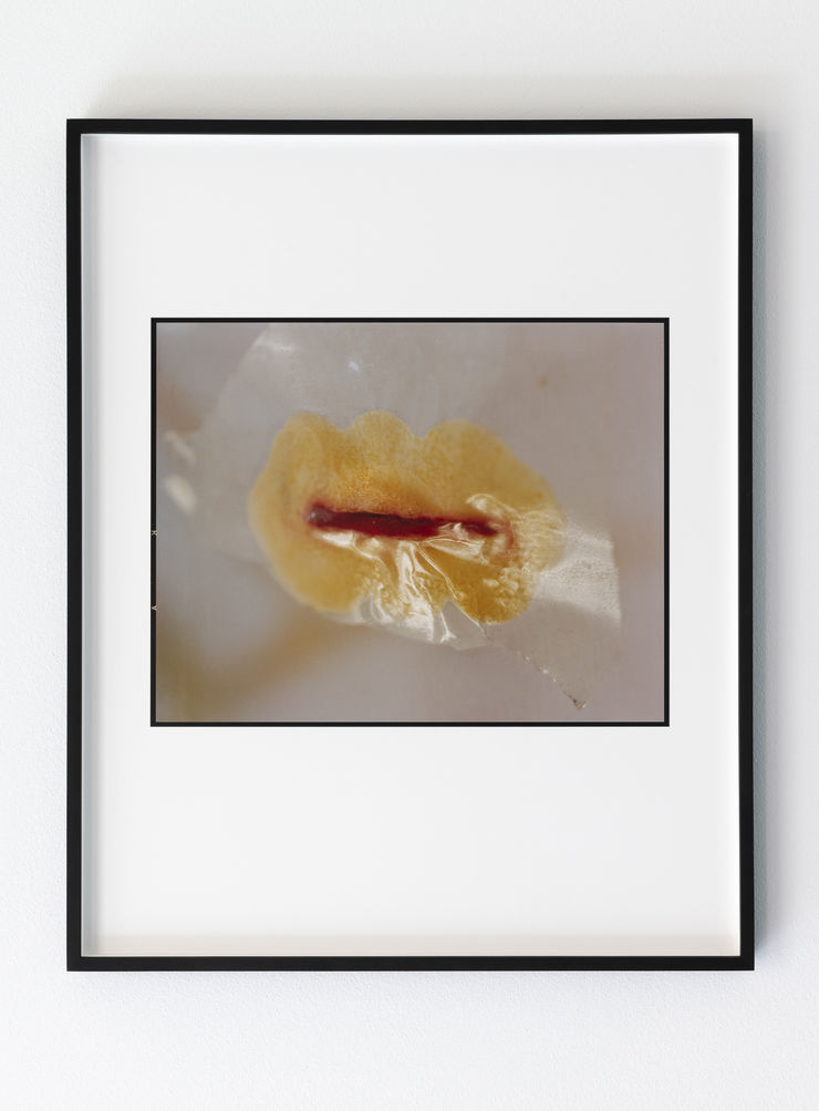 Ketuta Alexi-Meskhishvili Scar, 2022 Archival pigment print 30.5 x 37.5 cm | 12 x 14 3/4 in Ed. 1/2 + 2 AP