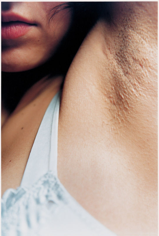 10 Images of Fraught Intimacy by Elinor Carucci