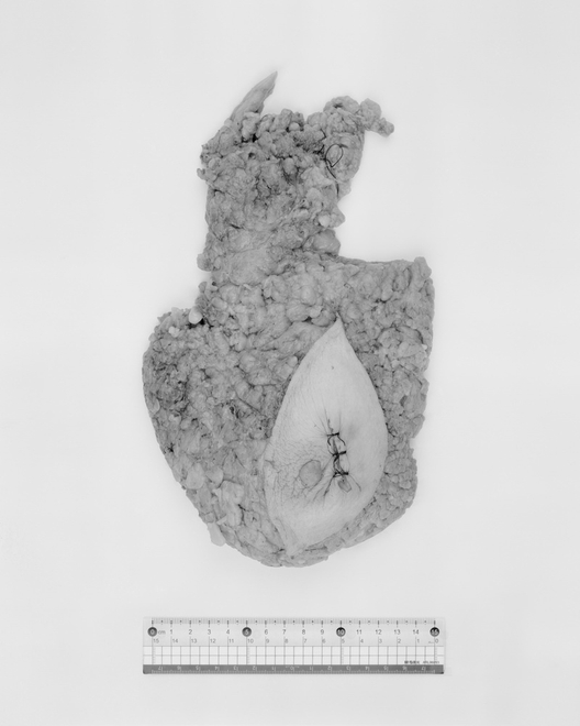 李朝晖 《大体：标尺下的器官09-胆囊》  Li Zhaohui SpecimenLHuman Organs Under a Ruler 09 - Gallbladder  2012 - 2013
