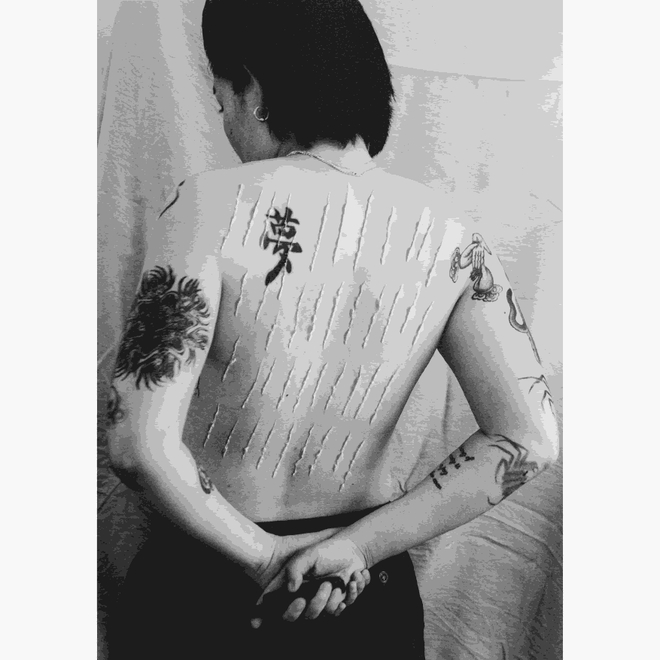 颜梦钰，《伤痕与梦想》，2025年。收藏级艺术微喷。  Meng-Yu Yan, Scars and Dreams, 2025. Giclee print.